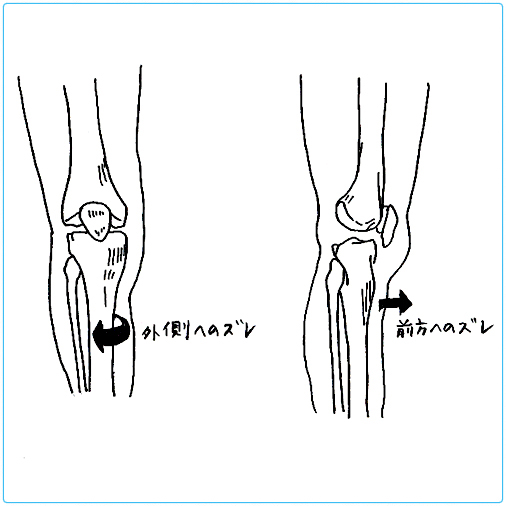 特に、膝の痛みに著効のバランスクリニック！！ | 鍼灸院 京都｜交通